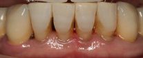 Cas Cliniques - Esthétique dentaire